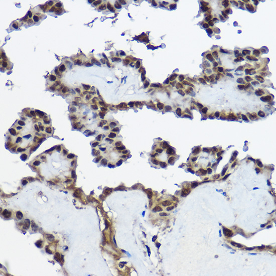 CSTB Rabbit Polyclonal Antibody - Image 2