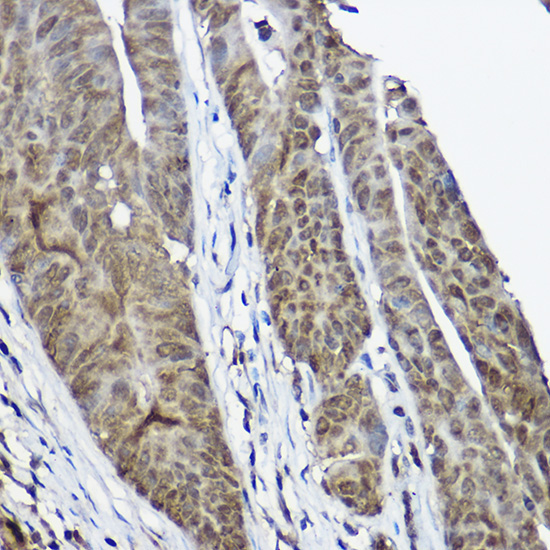 CSTB Rabbit Polyclonal Antibody - Image 3