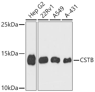 CSTB Rabbit Polyclonal Antibody