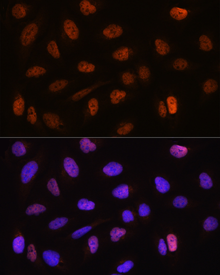 CSTF2T Rabbit Polyclonal Antibody - Image 2