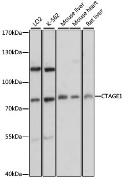CTAGE1 Rabbit Polyclonal Antibody
