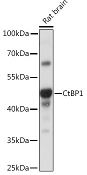 CtBP1 Rabbit Polyclonal Antibody - Image 2
