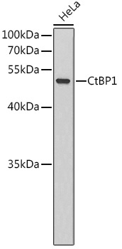 CtBP1 Rabbit Polyclonal Antibody