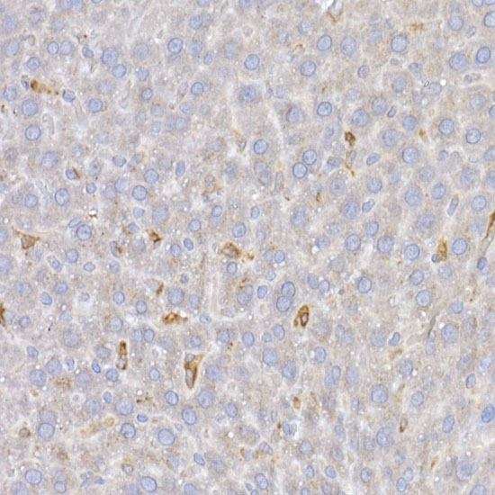 CTCF Rabbit Polyclonal Antibody - Image 2