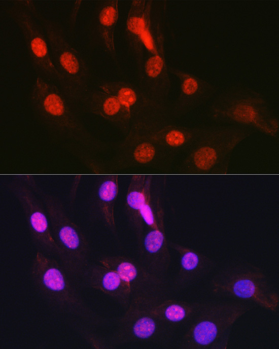 CTCF Rabbit Polyclonal Antibody - Image 3
