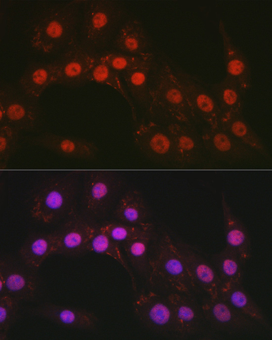 CTCF Rabbit Polyclonal Antibody - Image 4
