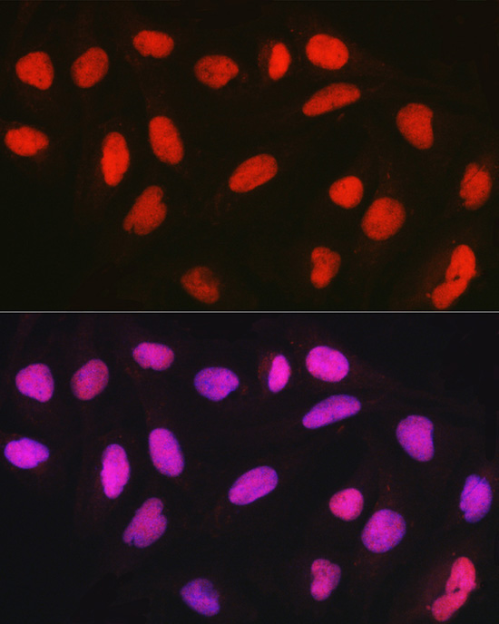CTCF Rabbit Polyclonal Antibody - Image 5