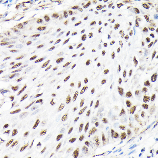 CTCF Rabbit Polyclonal Antibody - Image 2