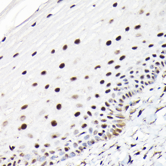 CTCF Rabbit Polyclonal Antibody - Image 3