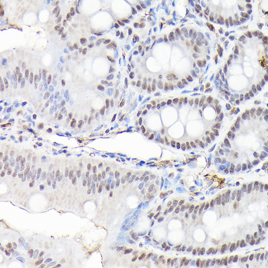 CTCF Rabbit Polyclonal Antibody - Image 4