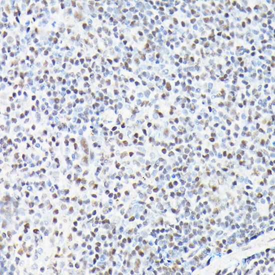 CTCF Rabbit Polyclonal Antibody - Image 5