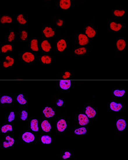 CTCF Rabbit Polyclonal Antibody - Image 6