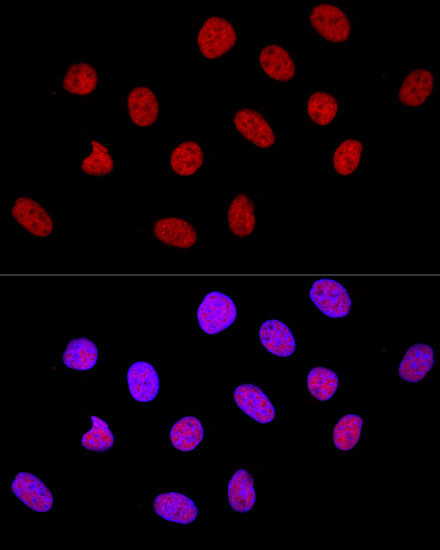 CTCF Rabbit Polyclonal Antibody - Image 7