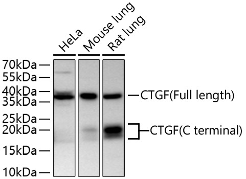 CTGF Rabbit Polyclonal Antibody