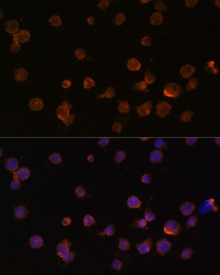 CTGF Rabbit Polyclonal Antibody - Image 2