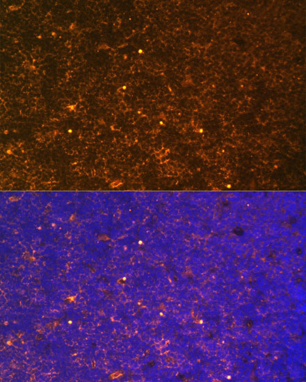 CTGF Rabbit Polyclonal Antibody - Image 3