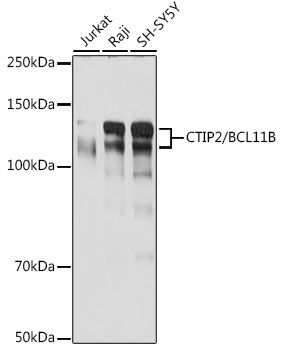 CTIP2/BCL11B Rabbit Monoclonal Antibody
