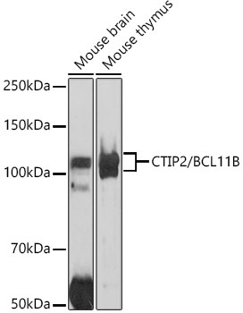 CTIP2/BCL11B Rabbit Polyclonal Antibody