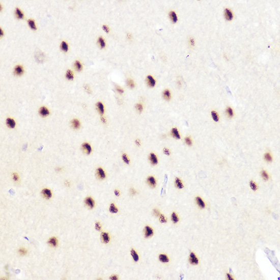 CTIP2/BCL11B Rabbit Polyclonal Antibody - Image 2