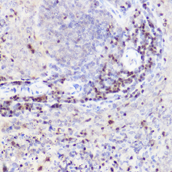 CTIP2/BCL11B Rabbit Polyclonal Antibody - Image 3