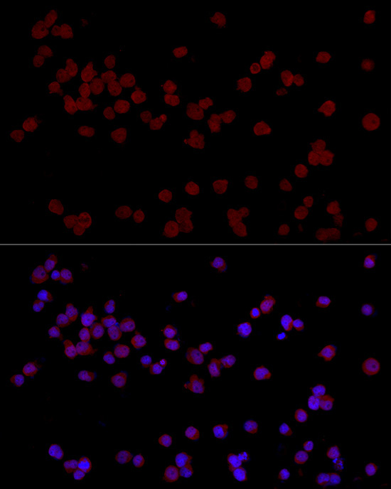 CTIP2/BCL11B Rabbit Polyclonal Antibody - Image 4