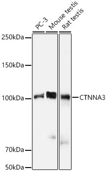 CTNNA3 Rabbit Monoclonal Antibody - Image 2