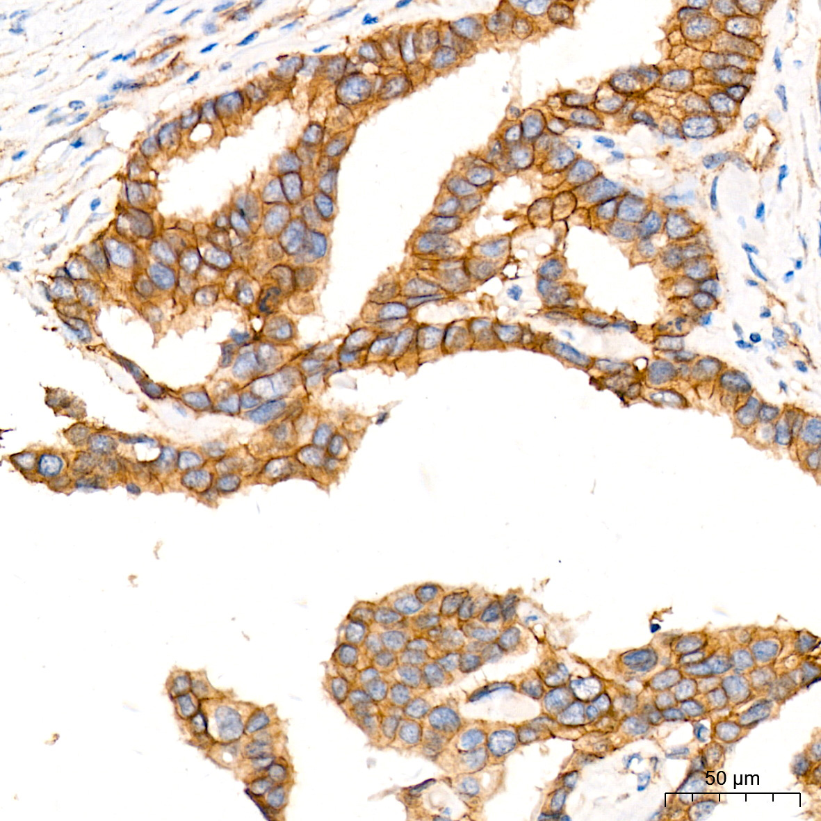 CTNNA3 Rabbit Monoclonal Antibody - Image 3