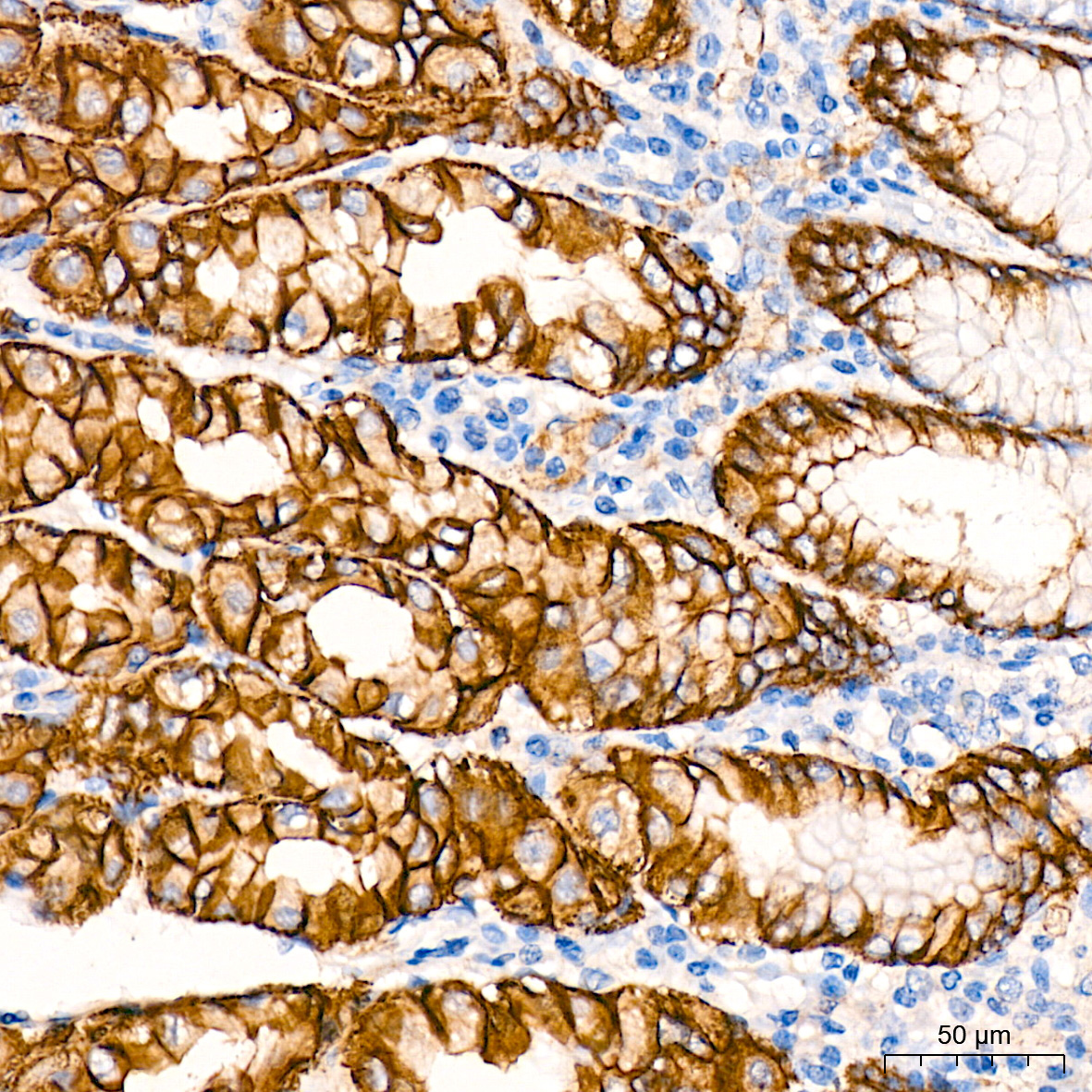 CTNNA3 Rabbit Monoclonal Antibody - Image 4