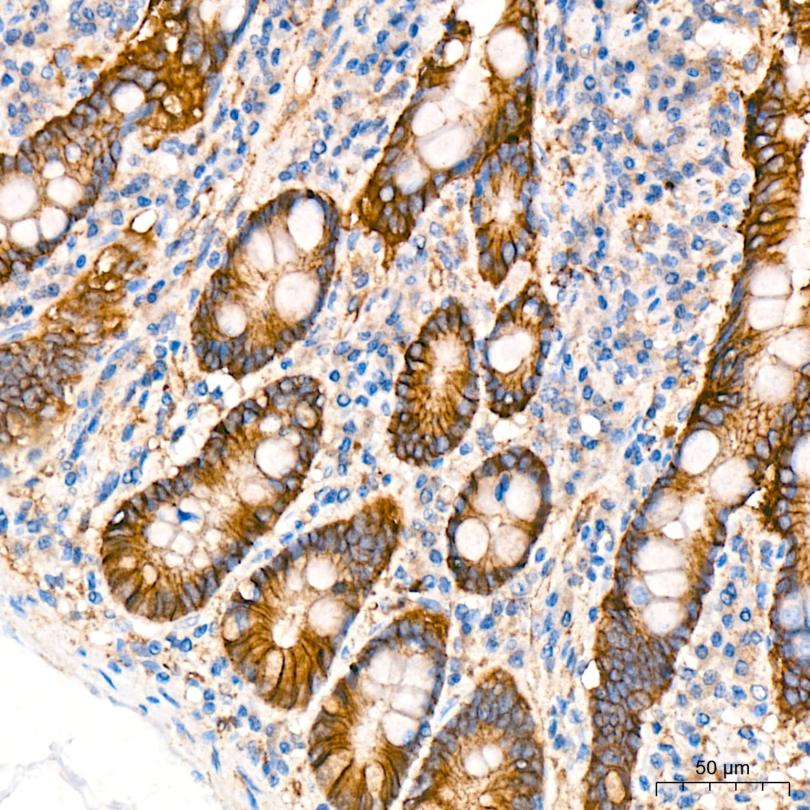 CTNNA3 Rabbit Monoclonal Antibody - Image 5