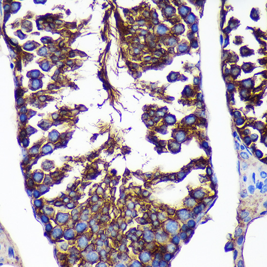 CTNNA3 Rabbit Polyclonal Antibody - Image 2