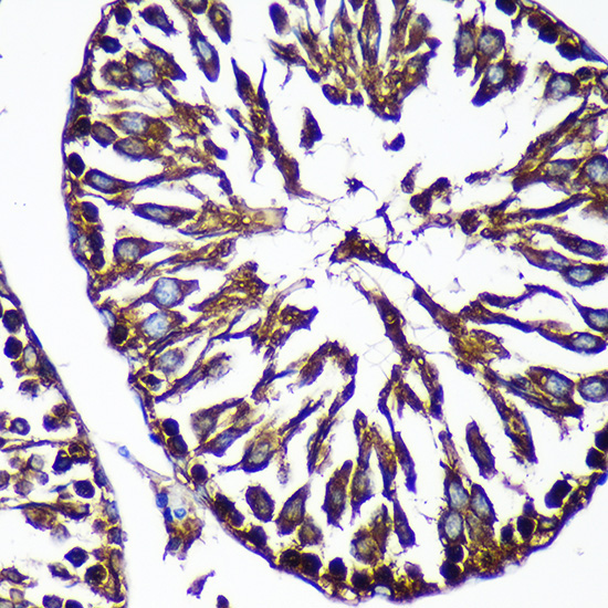 CTNNA3 Rabbit Polyclonal Antibody - Image 3