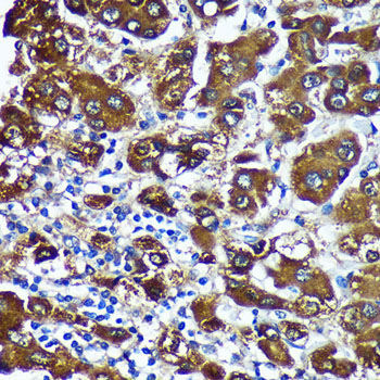 CTNNA3 Rabbit Polyclonal Antibody - Image 4
