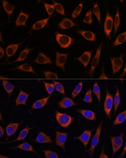 CTNNA3 Rabbit Polyclonal Antibody - Image 5