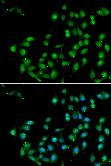 CTNNBL1 Rabbit Polyclonal Antibody - Image 2