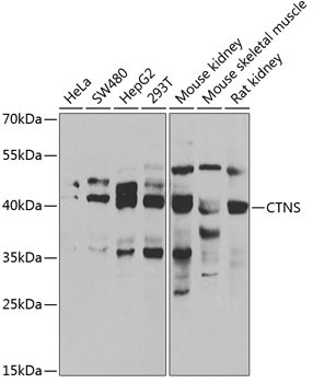 CTNS Rabbit Polyclonal Antibody