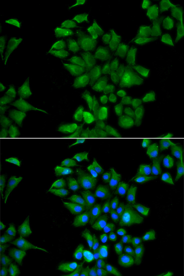 CTNS Rabbit Polyclonal Antibody - Image 2