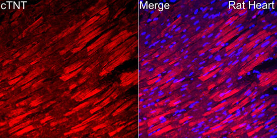 cTNT Rabbit Polyclonal Antibody