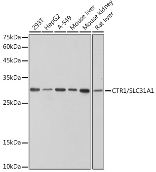 CTR1/SLC31A1 Rabbit Monoclonal Antibody