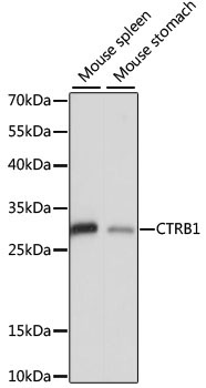 CTRB1 Rabbit Polyclonal Antibody
