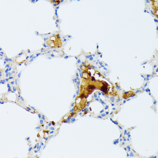 CTRB1 Rabbit Polyclonal Antibody - Image 2