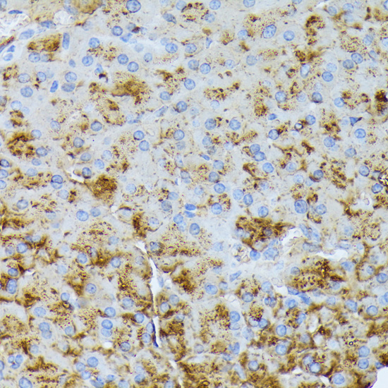 CTRB1 Rabbit Polyclonal Antibody - Image 3