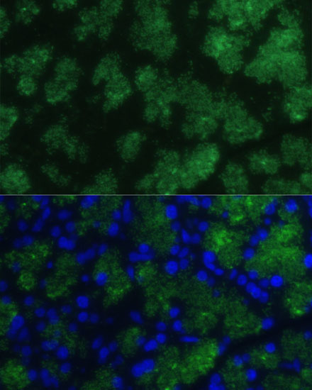 CTRB1 Rabbit Polyclonal Antibody - Image 4