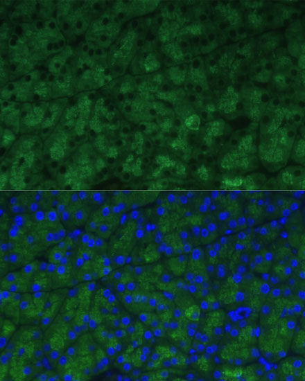 CTRB1 Rabbit Polyclonal Antibody - Image 5
