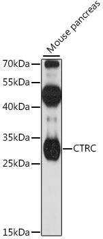CTRC Rabbit Polyclonal Antibody