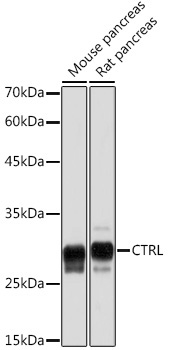 CTRL Rabbit Monoclonal Antibody
