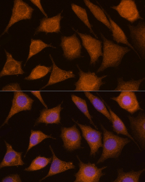 CTSC Rabbit Polyclonal Antibody