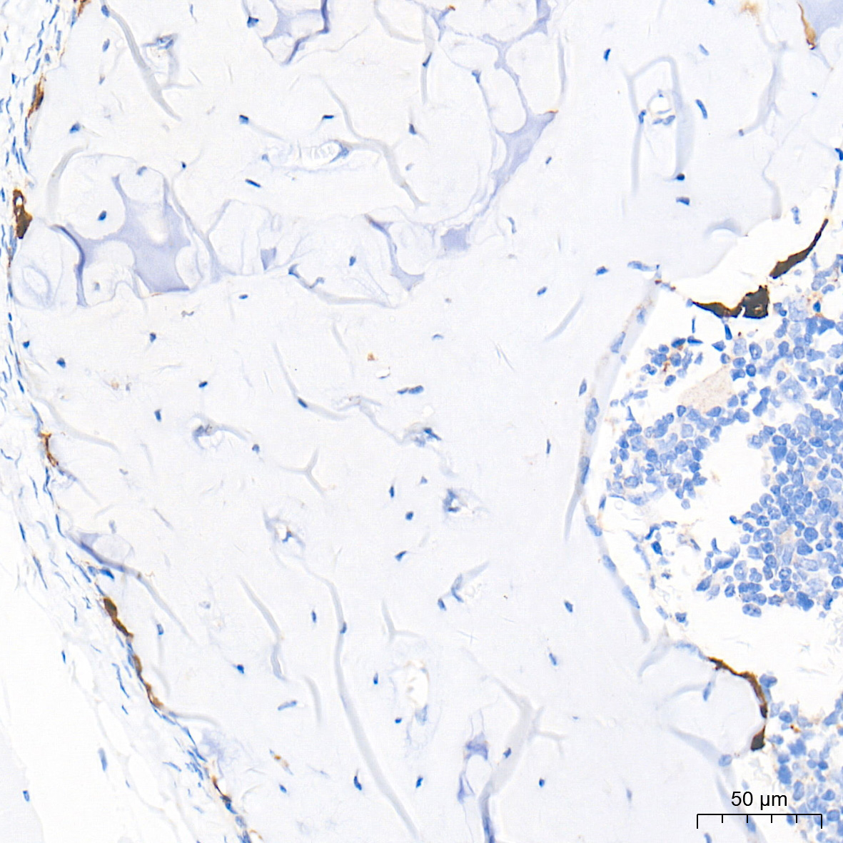 CTSK Rabbit Polyclonal Antibody - Image 2