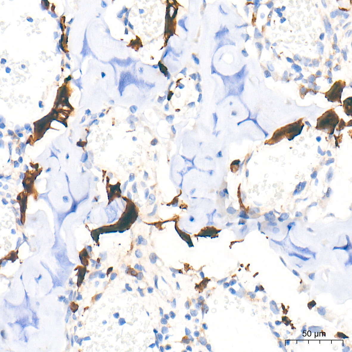 CTSK Rabbit Polyclonal Antibody - Image 3