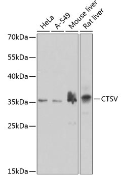 CTSV Rabbit Polyclonal Antibody