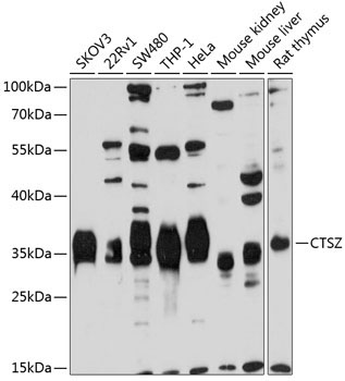 CTSZ Rabbit Polyclonal Antibody